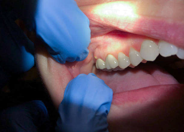 Professional Emergency Dental Service in MN